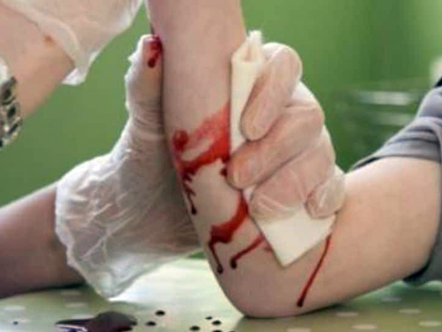 Οδηγίες για πρώτες βοήθειες σε έναν τραυματισμένο άνθρωπο με σοβαρή αιμορραγία