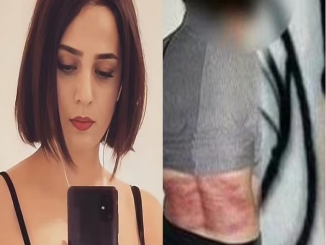 Ιράν: Μαστίγωσαν ανελέητα 74 φορές την 33χρονη γιατί δεν φορούσε τη μαντίλα